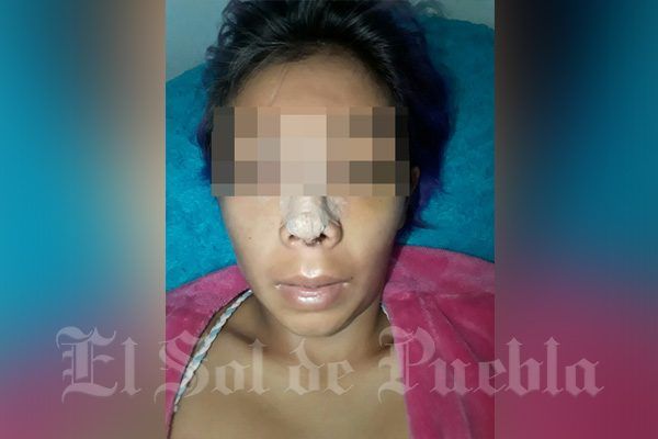 mujer golpeada en antro El tropico 600x400