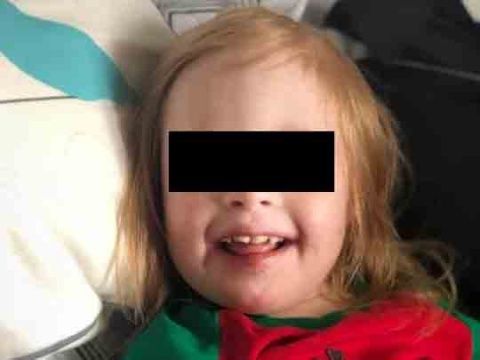 matan a nina con sindrome