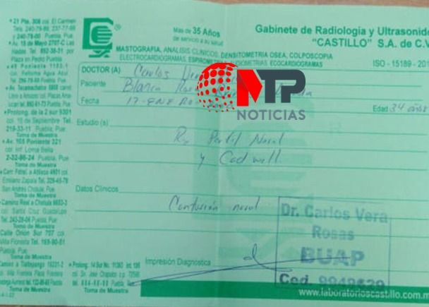 fractura nariz aurrera margarita2