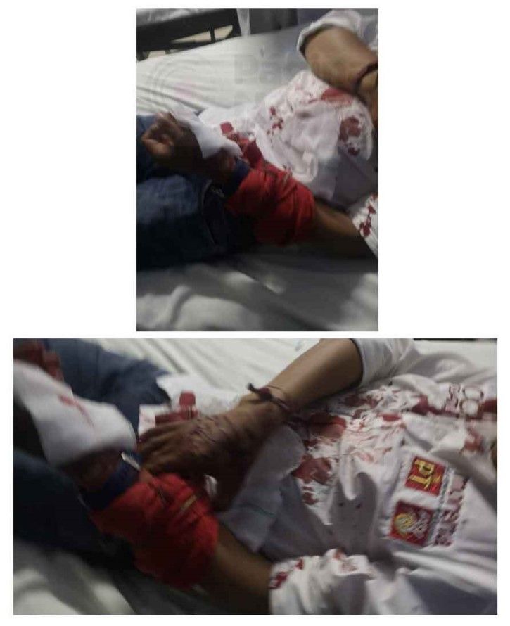 Pancoatl herido