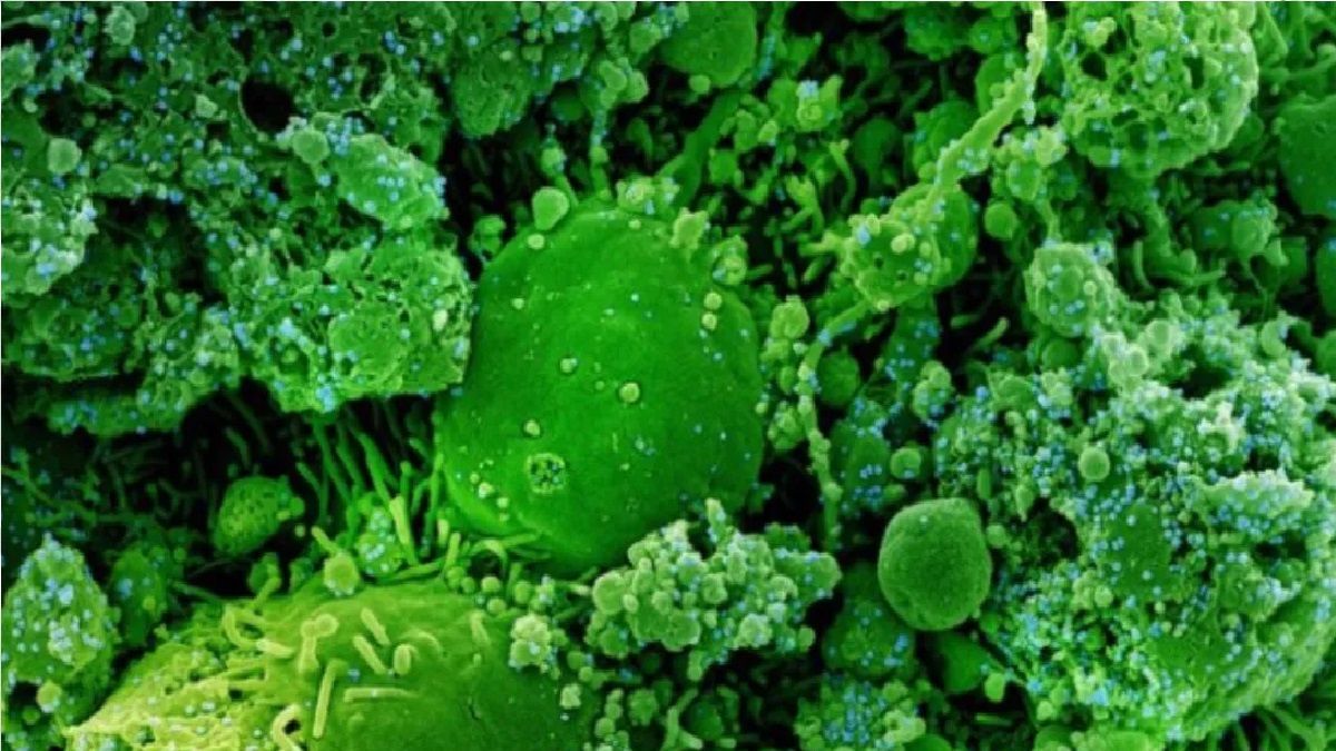 Estudio revela un antiviral de origen vegetal, eficaz para bloquear variante delta de la covid