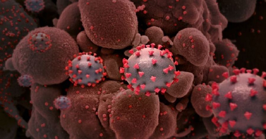 &iexcl;Por fin! Cient&iacute;ficos suecos descubren c&oacute;mo bloquear la infecci&oacute;n por covid-19