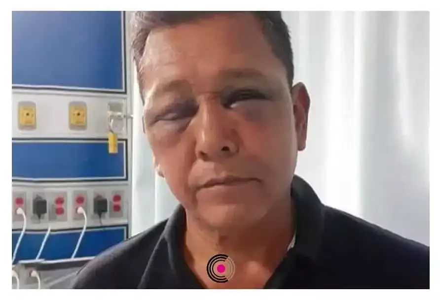 El profesor agredido acudió ante la Fiscalía regional en dónde levanto la denuncia correspondiente.