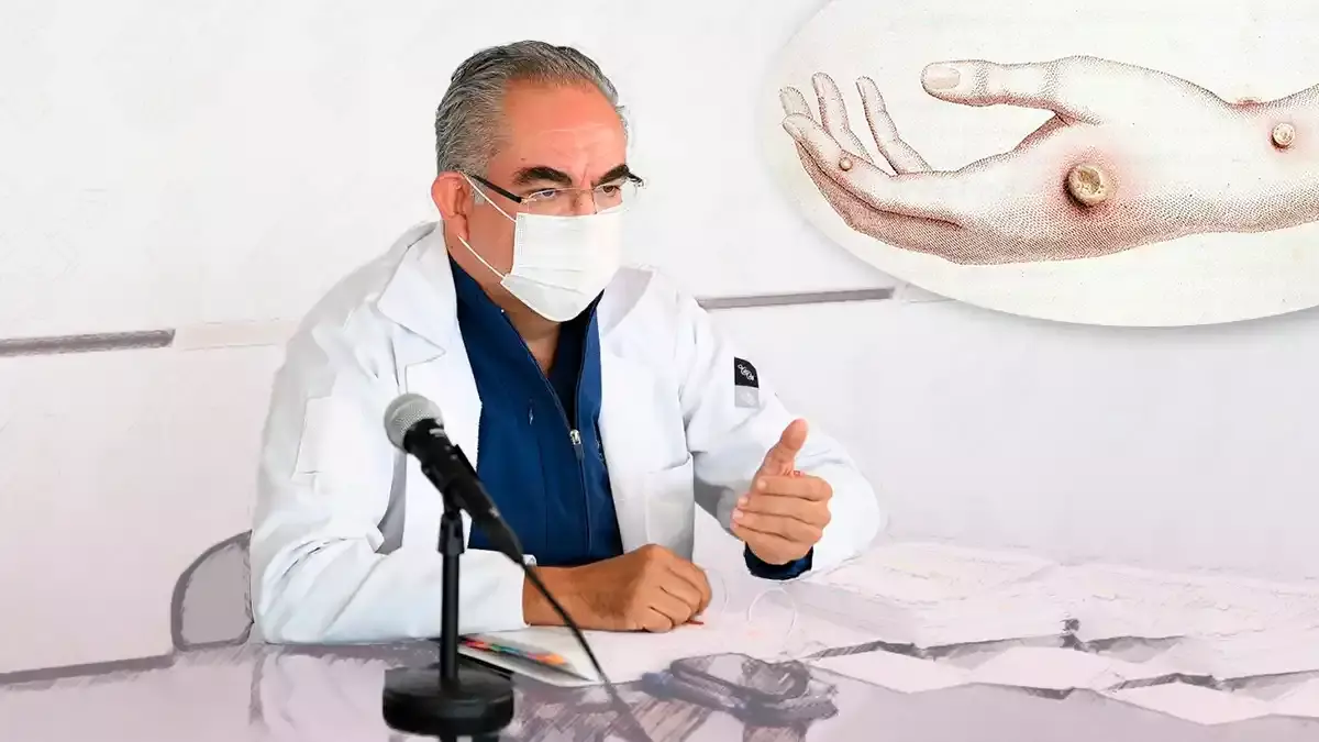 José Antonio Martínez, secretario de Salud.