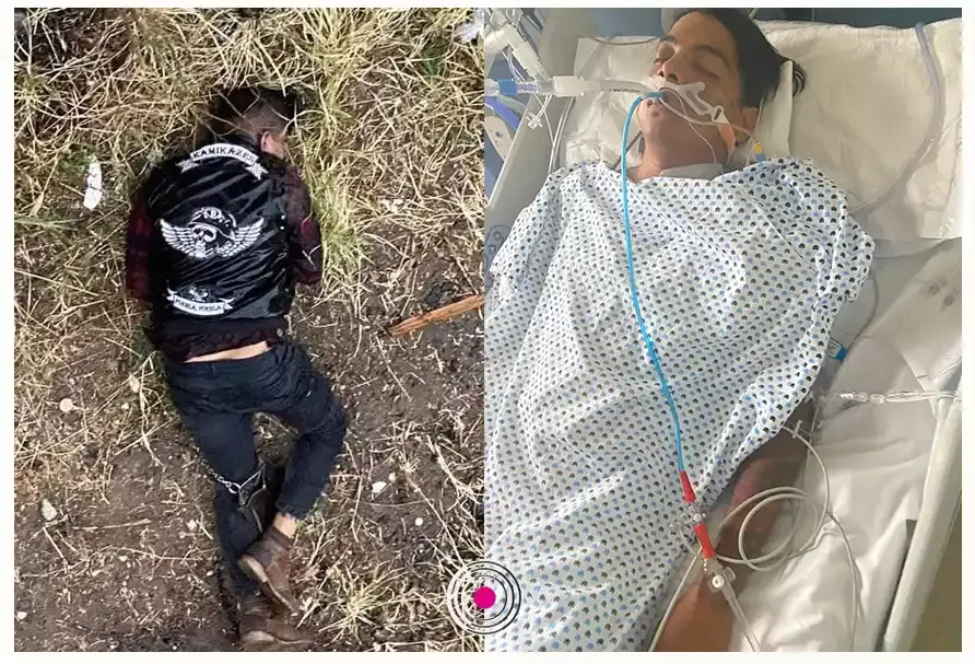 La víctima de la carambola está internada en el hospital Betania.